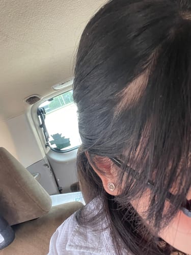 Customer photo review of Pre-Wash Scalp Oil by TR