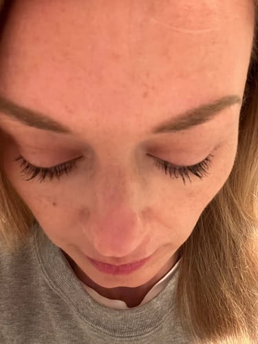 Customer photo review of LASH SERUM