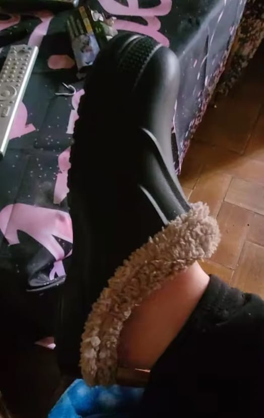 Customer photo review of Arlo Fuzzy - Healthy & Non-Slip Comfort Clog Mules