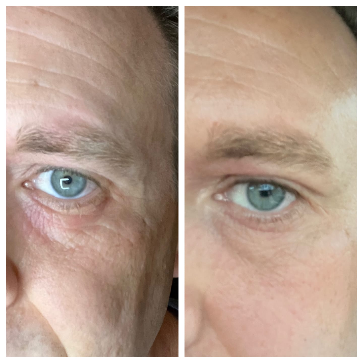 Customer photo review of Anti-Age & Glow Ritual