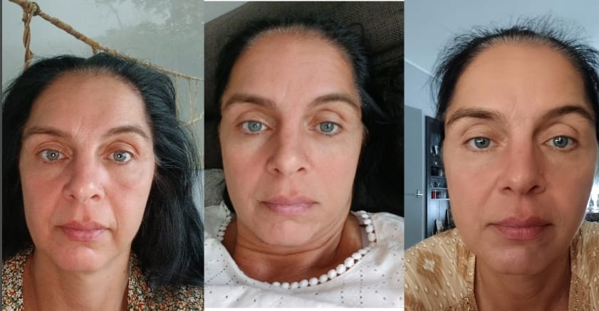 Customer photo review of Bliss™- Collageen Proteine