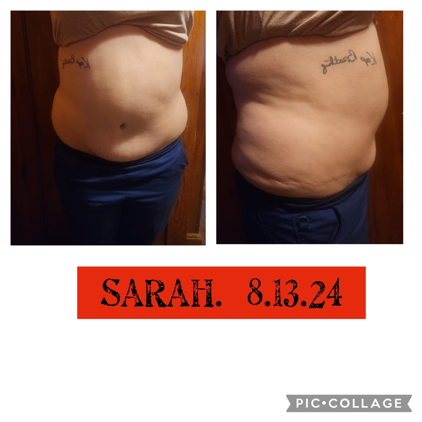 Customer photo review of Eris Lipo Cavitation Machine 6 in 1 Professional