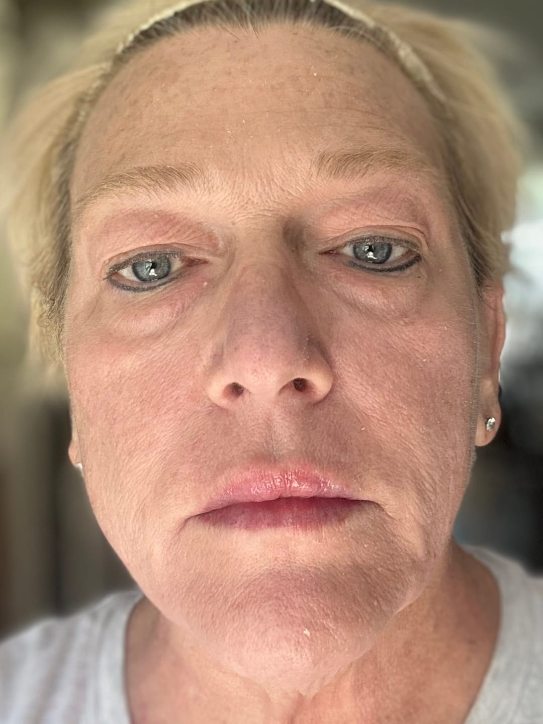 Customer photo review of Double Triple Retinol 1.6%