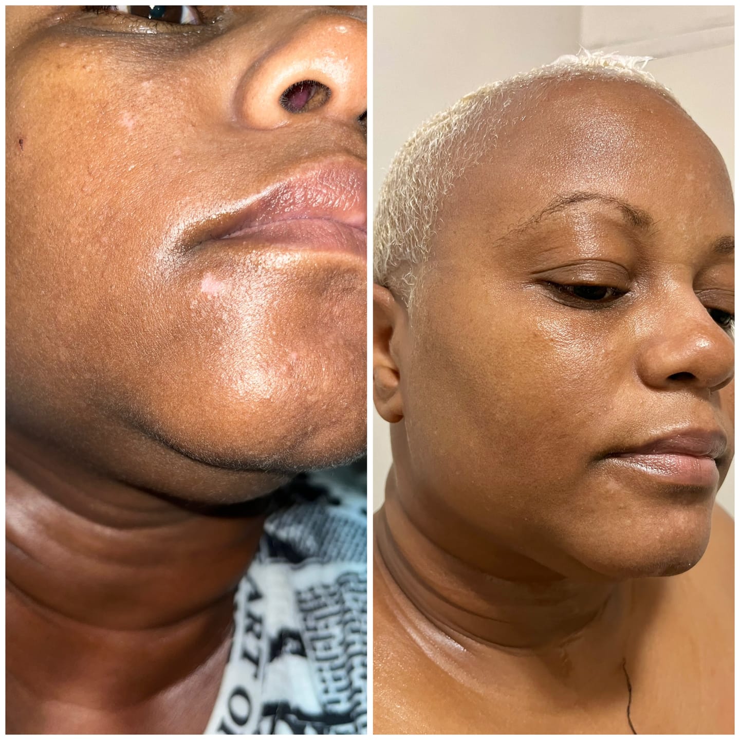 Customer photo review of Magic Eraser Dark Spot Cream