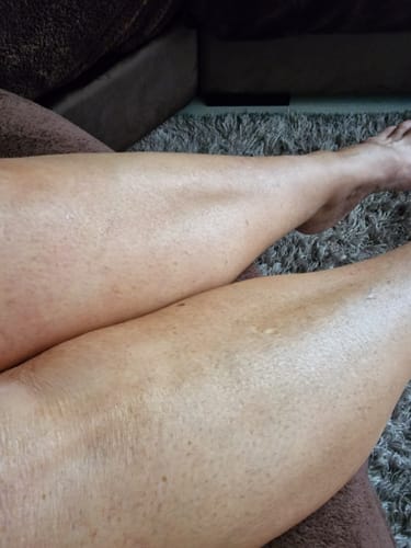 Customer photo review of SELF-TAN SET: BODY SERUM, GLOVES & BAG