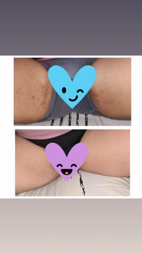 Customer photo review of LIMITED EDITION KIT Jolie’s Mini Full Body & Face Brightening Kit
