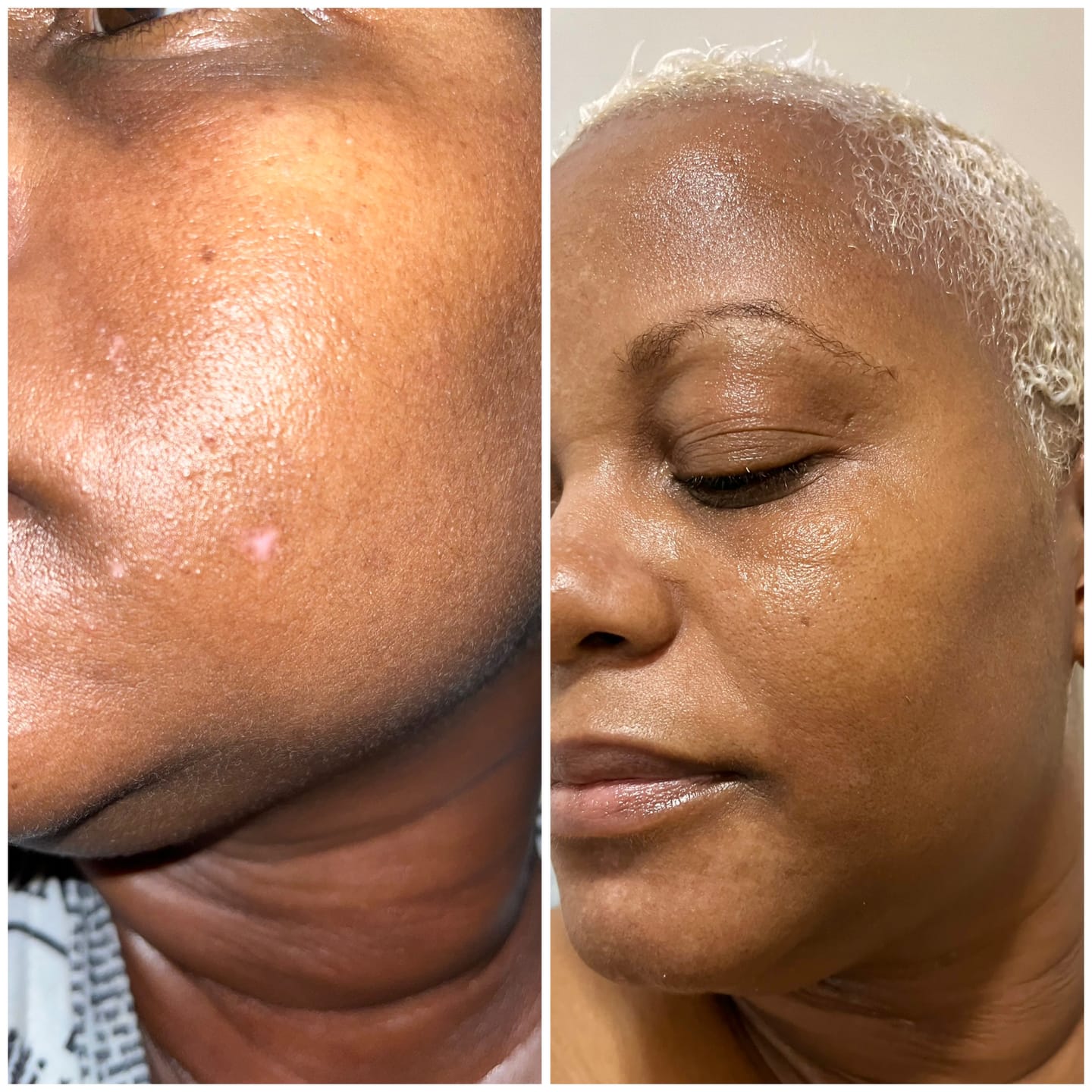 Customer photo review of Dark Spot Corrector Serum