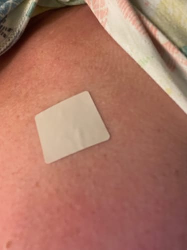 Customer photo review of Melatonin Pflaster