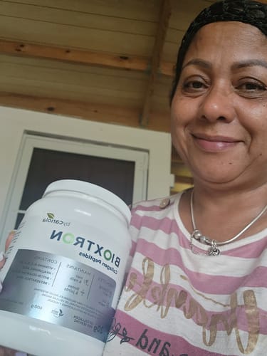 Customer photo review of Bioxtron | Collagen Peptides