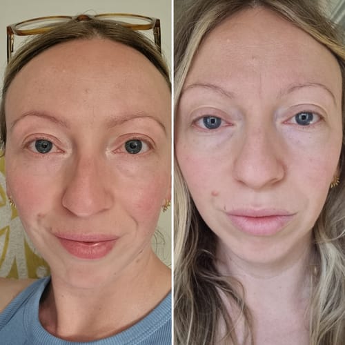 Customer photo review of Pure NMN | 500mg Capsules