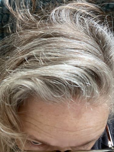 Customer photo review of Sunkissed Starter Kit