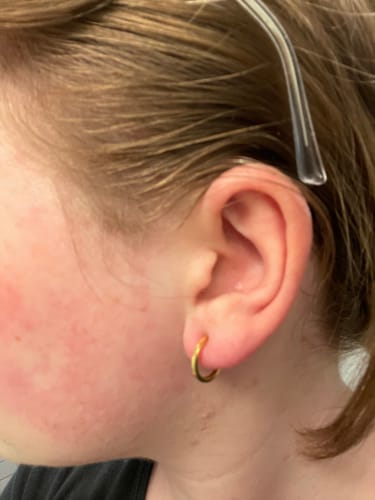 Customer photo review of Mini Hoop Clip On Earrings