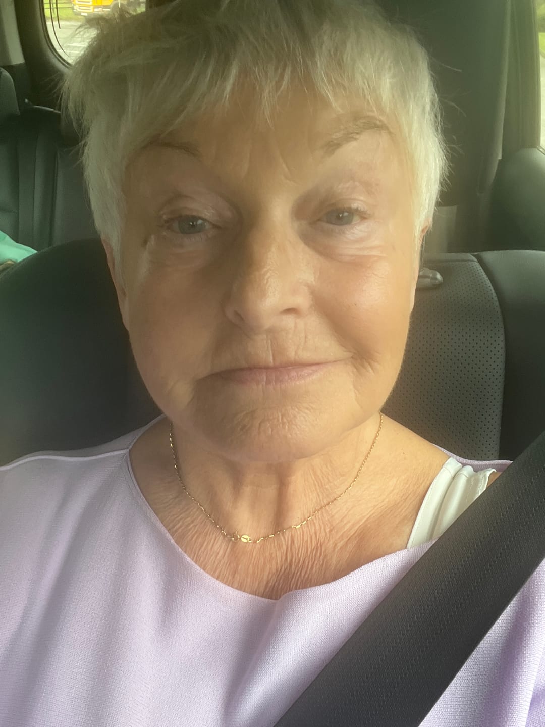 Customer photo review of Rosalique 3 in 1 Anti-Redness Miracle Formula SPF50