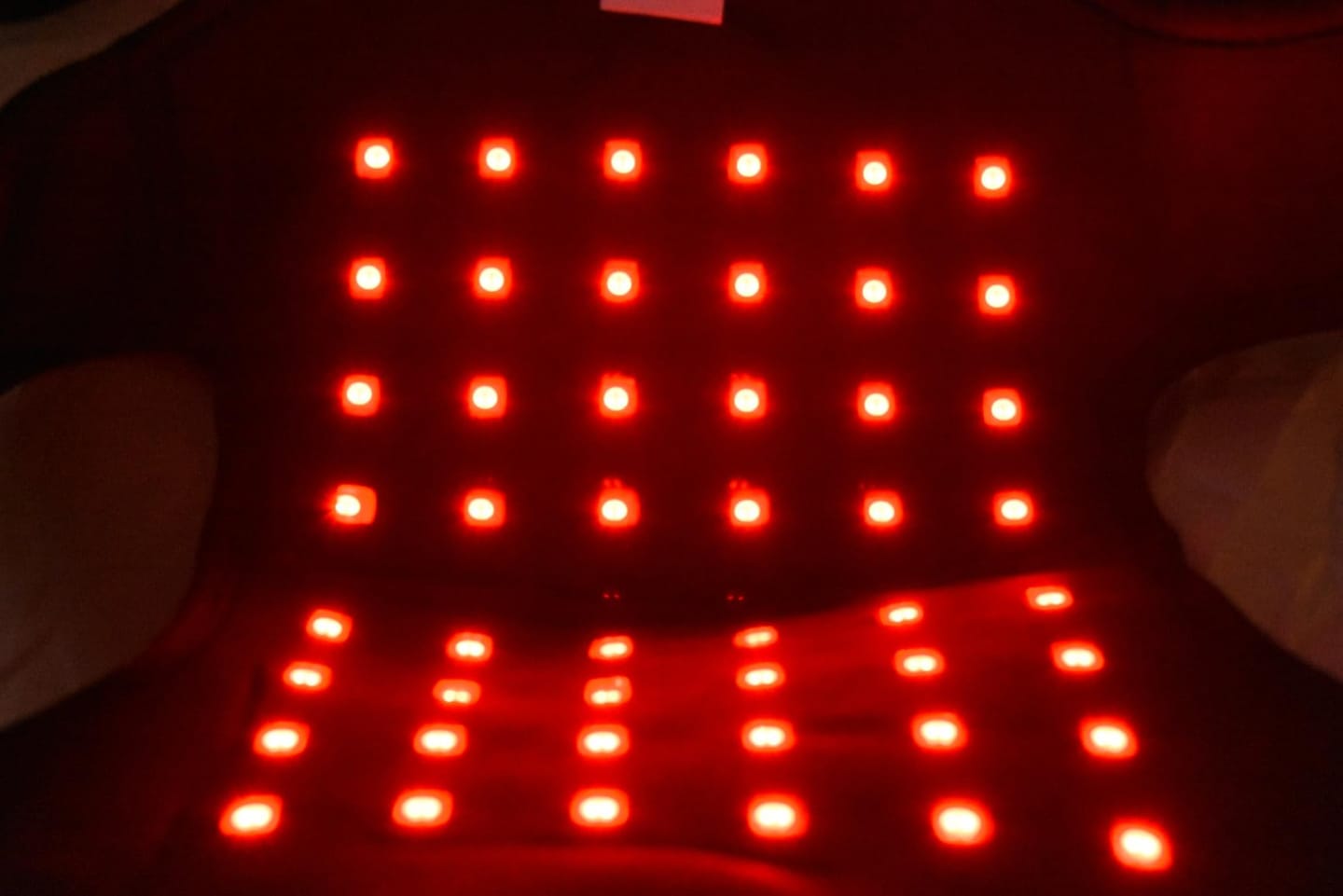 Customer photo review of RLB BlinkRecover - Red Light Therapy Leg Wrap Pro