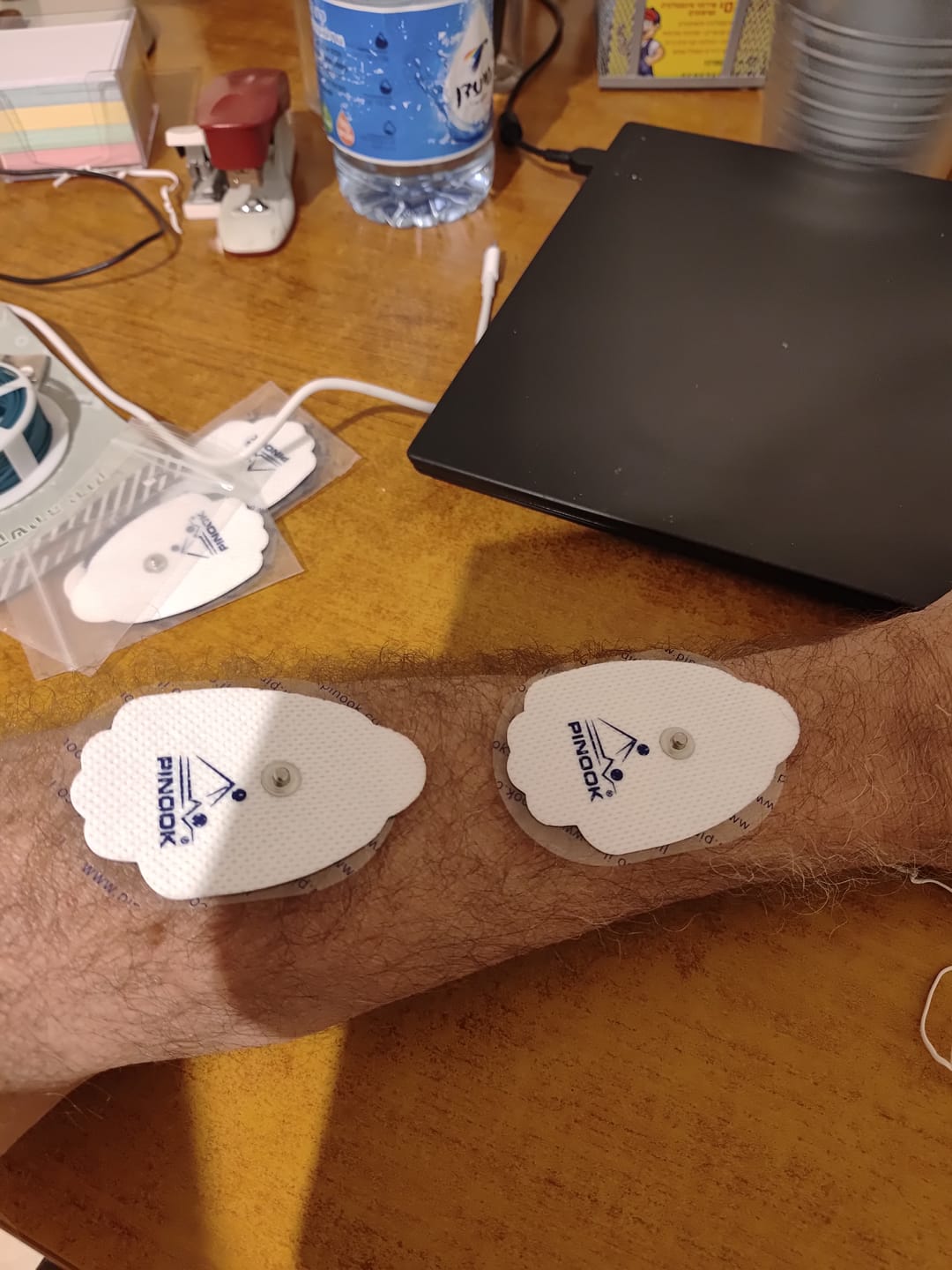 Customer photo review of 5 זוגות אלקטרודות
