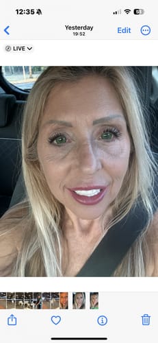 Customer photo review of Vega Bright Forest Green Prescription Colored Contact Lenses