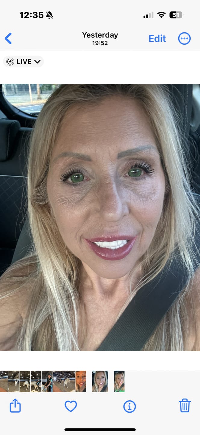 Customer photo review of Vega Bright Forest Green Prescription Colored Contact Lenses
