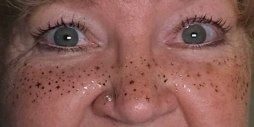 Customer photo review of Gold Stardust Speckles Makeup Patches