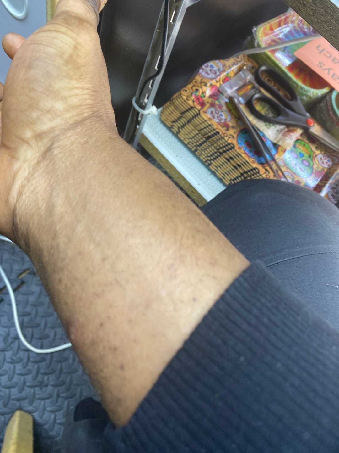 Customer photo review of Ultra Bright Brightening Gel
