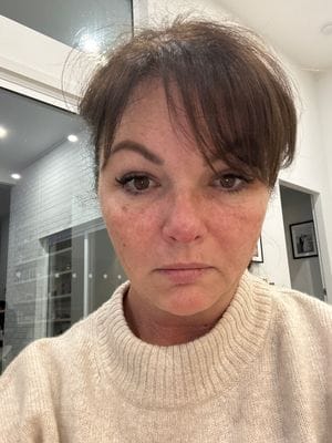 Customer photo review of LuminaLux Rejuvenate - 4 Color LED Mask