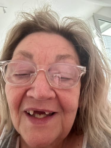 Customer photo review of Teeth-Veneer 2.0