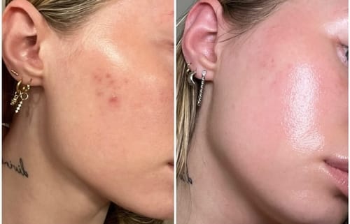 Customer photo review of Tisane Glow up ®