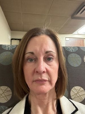 Customer photo review of LuminaLux Rejuvenate - 4 Color LED Mask
