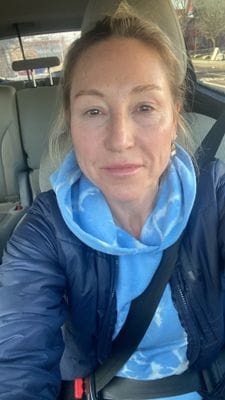 Customer photo review of LuminaLux Rejuvenate - 4 Color LED Mask