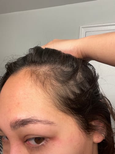 Customer photo review of Pre-Wash Scalp Oil by TR