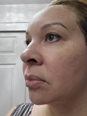 Customer photo review of LuminaLux Rejuvenate - 4 Color LED Mask
