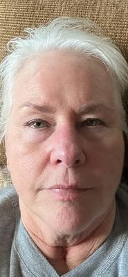 Customer photo review of LuminaLux Rejuvenate - 4 Color LED Mask