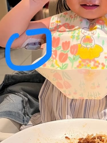 Customer photo review of Skin Grip Original - Dexcom G6 Patches