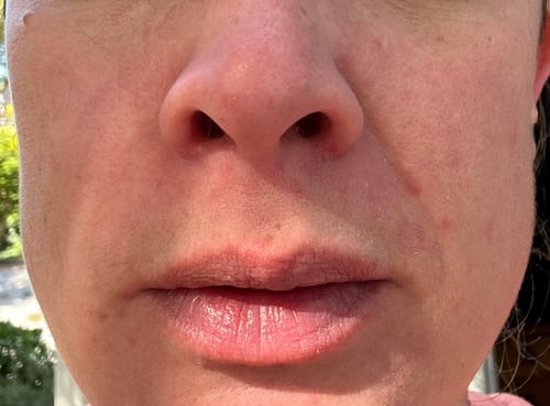 Customer photo review of Healing Balm
