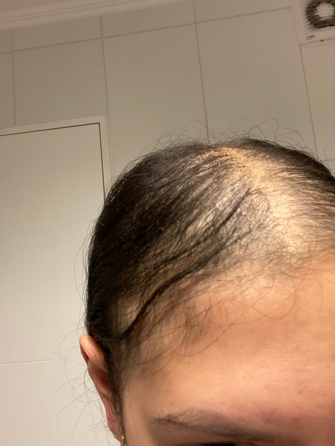 Customer photo review of PACK ANTICAÍDA DE CABELLO PARA 1 MES