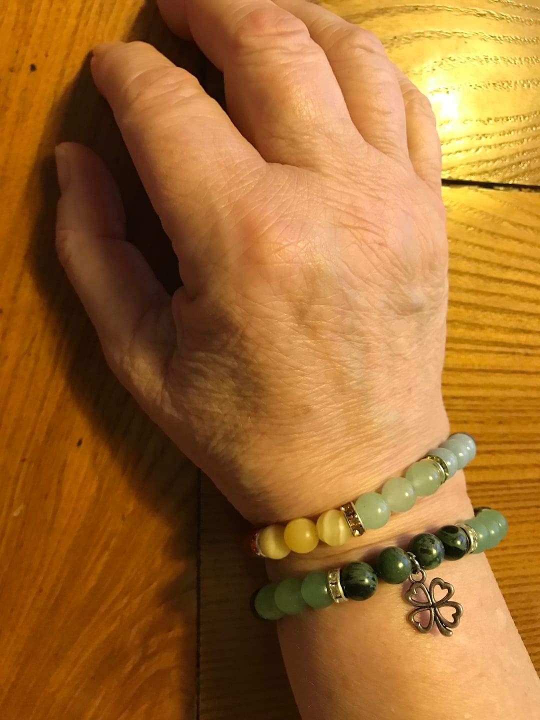 Customer photo review of Armband Bernstein
