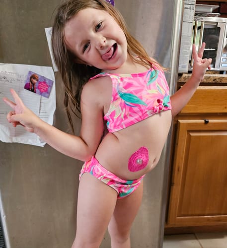 Customer photo review of Skin Grip Original - Universal Adhesive Patches (0.8 inch Hole)