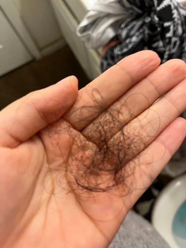 Customer photo review of Pre-Wash Scalp Oil by TR