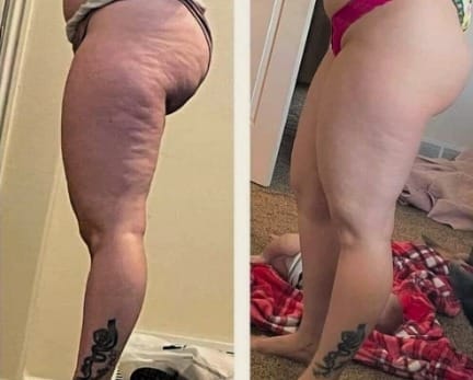 Customer photo review of CelluLuxe Pro - Straffe deinen Körper in nur 10 Minuten täglich ganz bequem von zu Hause.