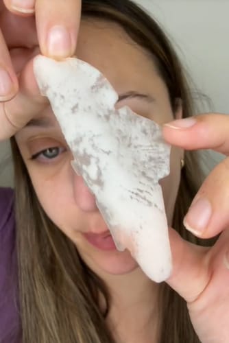 Customer photo review of Luelle Pimple Patches