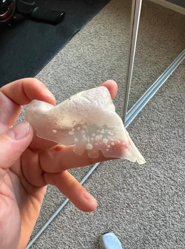 Customer photo review of Luelle Pimple Patches