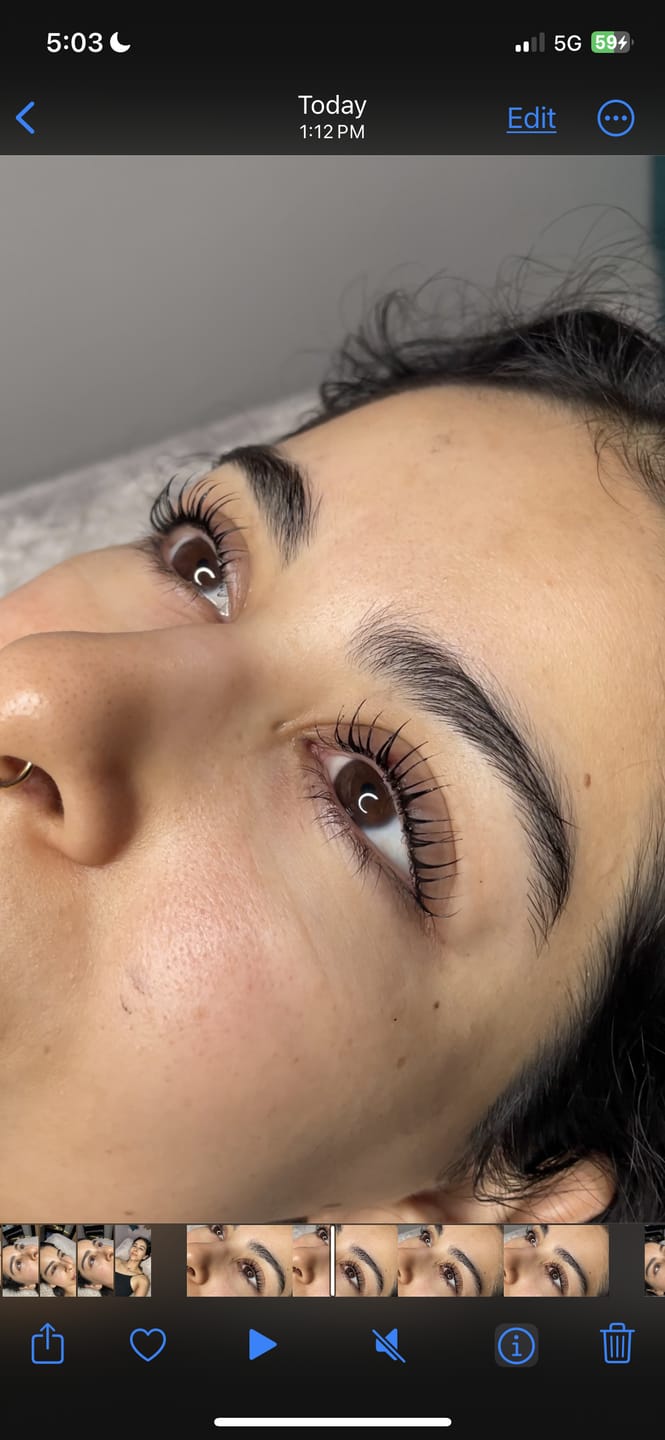 Customer photo review of Glue-Free Flexi Shields