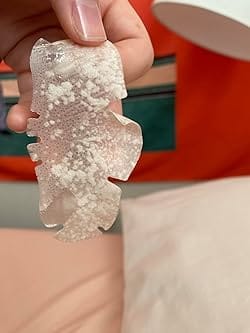 Customer photo review of Luelle Pimple Patches