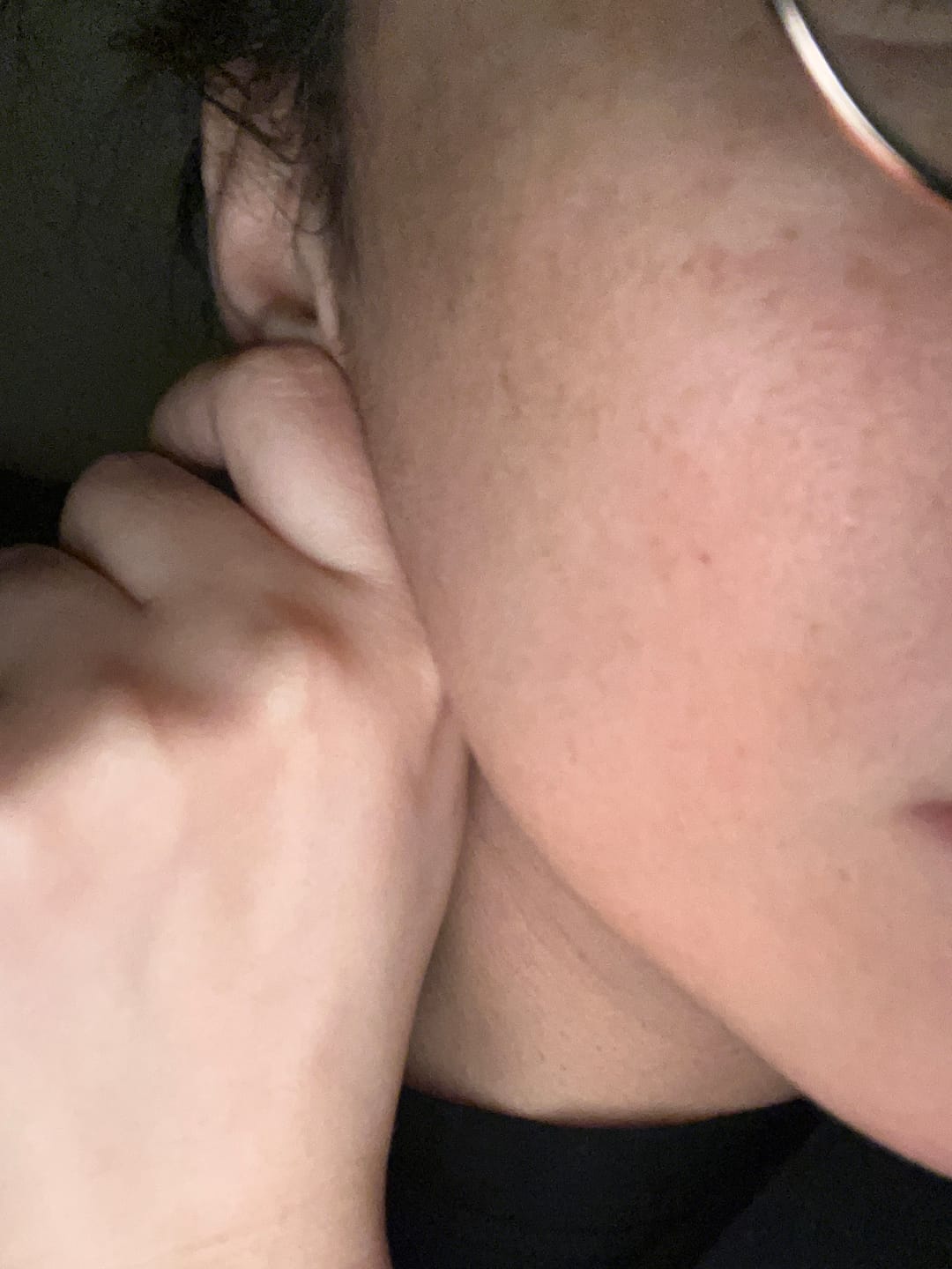 Customer photo review of Anua - Huile nettoyante - Heartleaf Pore Control Cleansing Oil