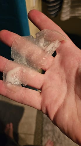 Customer photo review of Luelle Pimple Patches