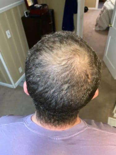 Customer photo review of Spray capillaire à croissance rapide