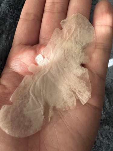 Customer photo review of Luelle Pimple Patches