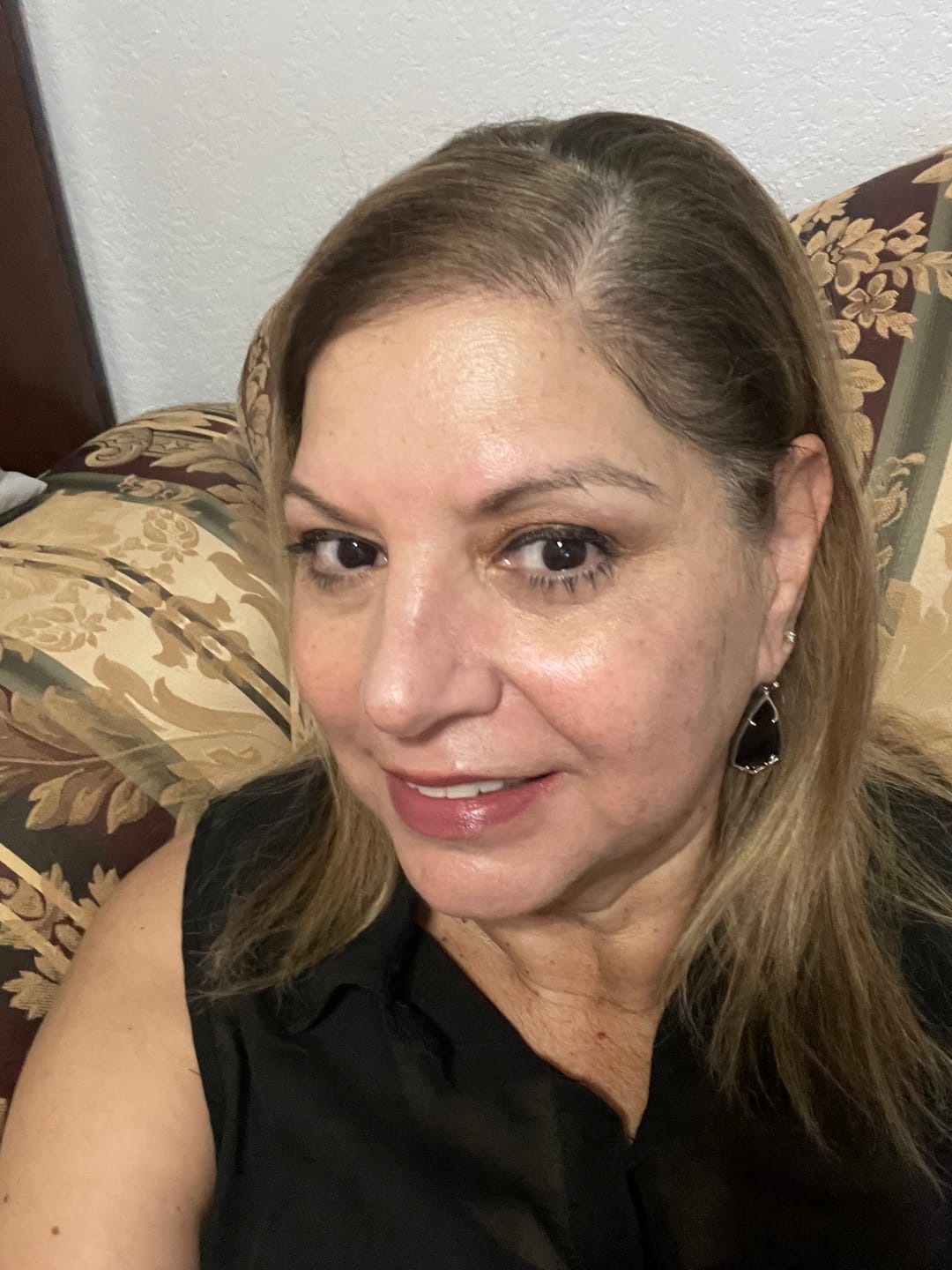 Customer photo review of Psoriasis Honey Ultimate Relief Kit