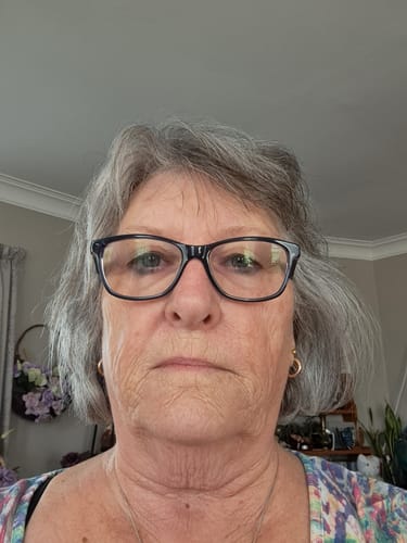 Customer photo review of Acne/ Combination Skin - Kiri Aroha Facial Serum