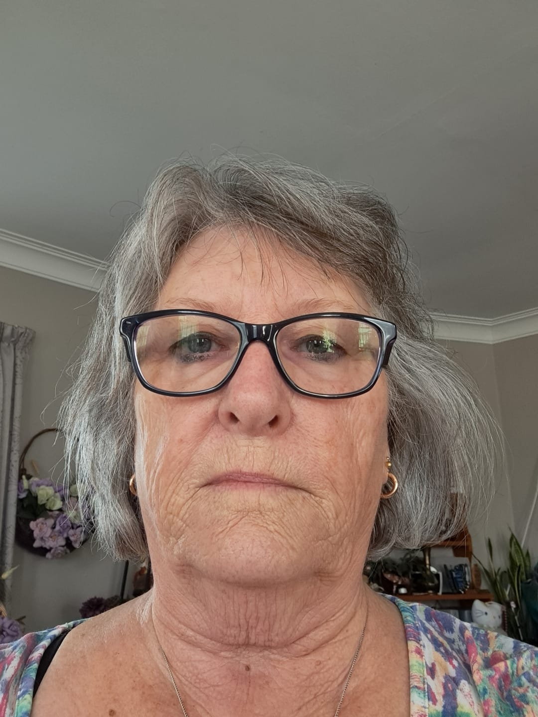 Customer photo review of Acne/ Combination Skin - Kiri Aroha Facial Serum