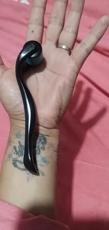 Customer photo review of Dermaroller Visage